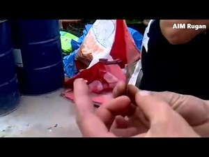 blood cyst infection pimple popping