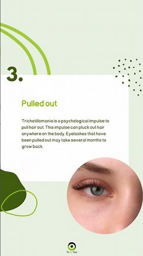 Why Do Eyelashes Fall Out? Causes Of Eyelash Loss