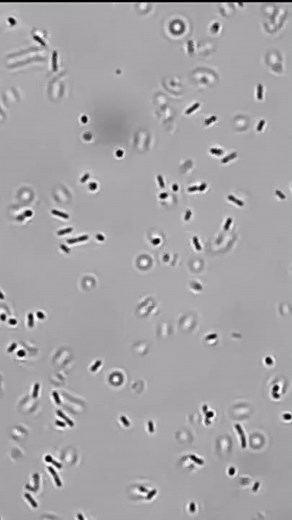 Tumbling motility In Listeria monocytogenes |Captured By Jitendra Kumar |