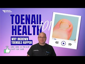Toenail Health 101: Why Ingrown Toenails Happen (and How to Prevent Them for Good)