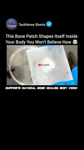 This Bone Patch Remembers Its Shape And Fixes Broken Bones 🤯🦴 #shorts#engineering