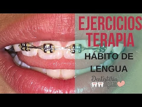 15 Ejercicios para Hábito de Lengua en Casa - Deglución Atípica