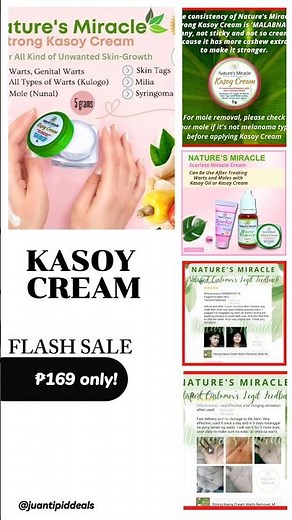 Strong Kasoy Cream warts remover original mole remover kasoy cream wart removal by Nature's Miracle