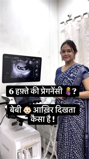 1.5 महीने का बेबी सोनोग्राफी में कैसा दिखता है ? #pregnancy #ultrasound #firsttrimester