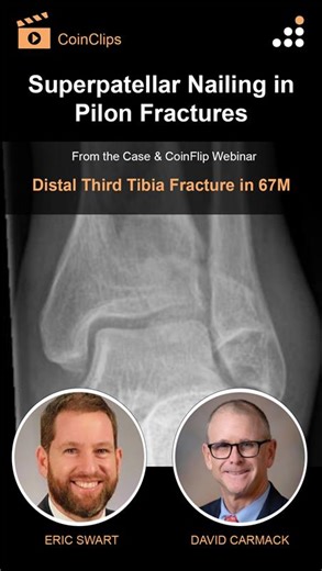 2.3K views · 15 reactions | Here is a clip from our latest episode of...