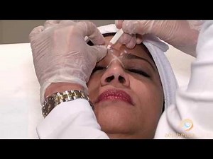 Botulinum Toxin Injections: Short introductory tutorial
