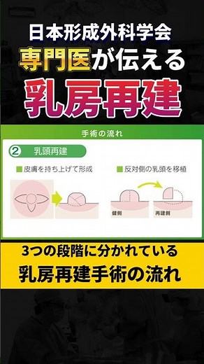 乳房再建手術の流れ - 形成外科学会専門医が解説