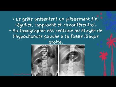 Radiographie de l’Abdomen Sans Préparation -LES OCCLUSIONS- Partie 01