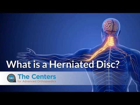 What is a Herniated Disc?
