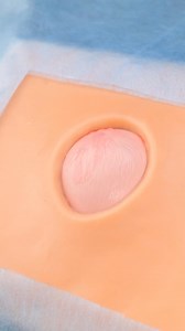 8.8M views · 65K reactions | Surgical Secrets Doctors Don’t Usually Share | 5-Minute Workouts | Facebook