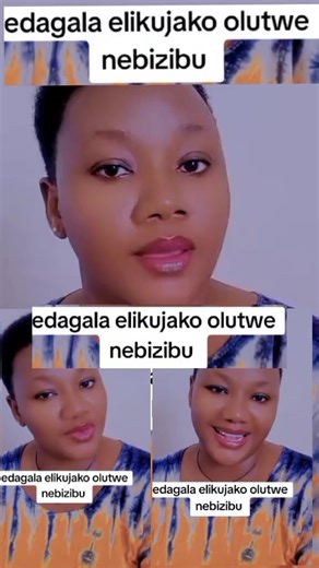 Eddagala Elikujako Olutwe Nebizibu - Musawo Jolly