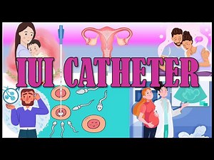 IUI catheter (INTRA UTERINE INSEMINATION CATHETER)