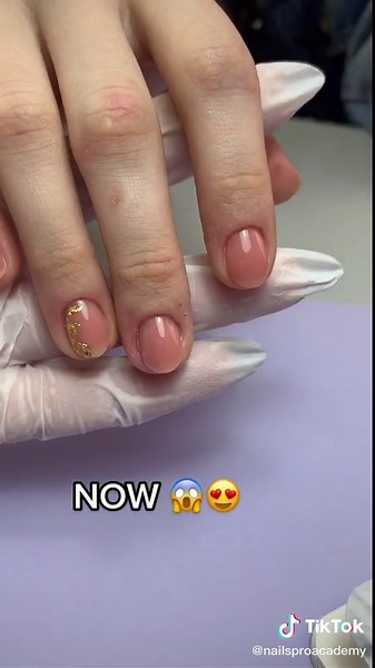 Bitten Nails Transformation Before and After: Nail Studio Success Story
