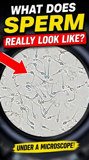 What happens when you put sperm under a microscope? ‼️🤯 #science #microscope #biology