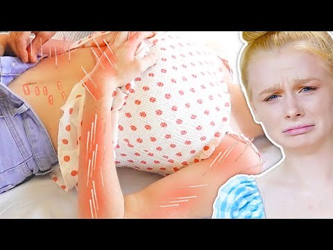 I try ACUPUNCTURE for FIRST TIME!