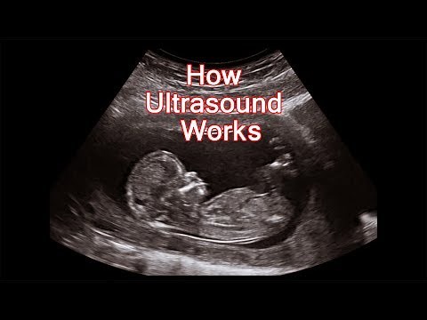 How Ultrasound Machine Works - Animated