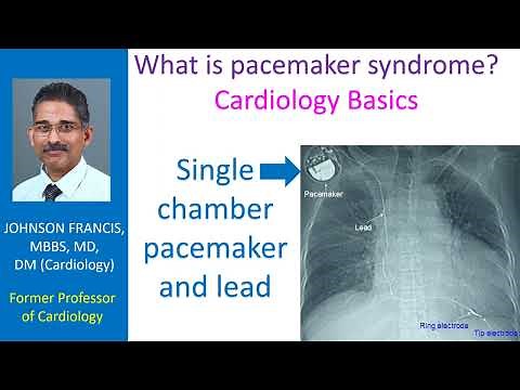What is pacemaker syndrome? Cardiology Basics