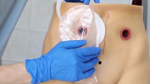 One Piece Colostomy Bags, 10 PCS Drainable Pouches with Clamp Closure, Ostomy Supplies for Ileostomy Urostomy Stoma Care, Cut to Fit Max 20-60mm Non-Woven Lining