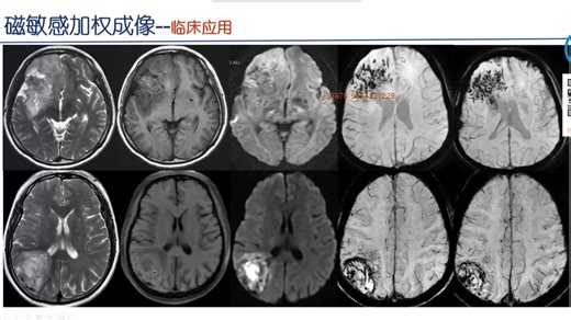 神经系统检查规范与技术解读