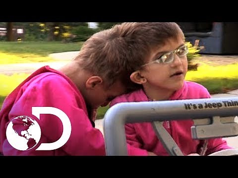 Gemelas Siamesas | Mi Cuerpo, Mi Desafío l Discovery Latinoamérica