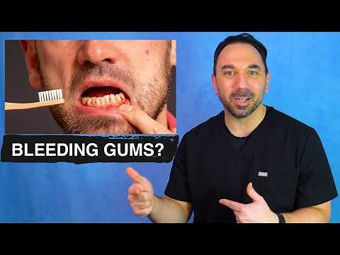 STOP Bleeding Gums Naturally! Dr Katranji's at-Home Guide 🩸🦷