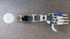 A low-cost, 3D-printed transhumeral prosthesis | Arduino Blog