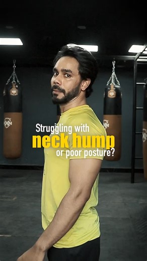 Shaan on Instagram: "🔥 Got a Neck Hump or Forward Head Posture? Fix it naturally! These Top 3 Exercises will help you correct posture, strengthen your neck, and eliminate that “Tech Neck” hump. 💪 No surgery. No equipment. Just 10 mins daily! #neckhumpfix #ﬁtnesstips #shaandaarfit"