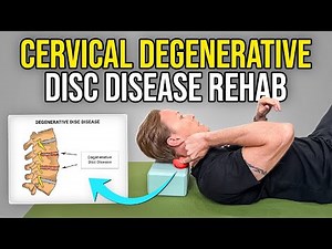 4 Exercises for Cervical Degenerative Disc Disease