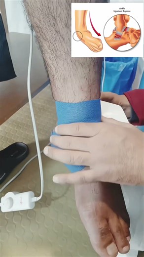 Ankle Taping: DO THIS, NOT THAT 🚫 #painrehabb #viral #anklesprain #shorts #shortvideo #viralvideo