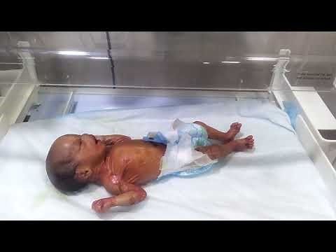 Skin problem in Newborn babies a guide for parents