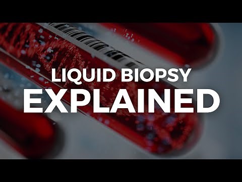 How Does Liquid Biopsy Work?