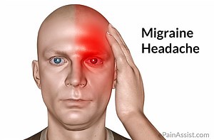Resolve migraine headaches by addressing the atlas and thoracic outlet