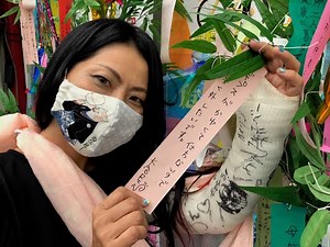 Long term LAC 腕ギプス生活