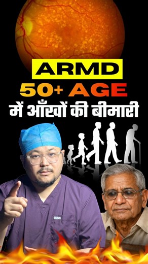 Silent Eye Disease After Age of 50 | ARMD Explained #facts #eyes