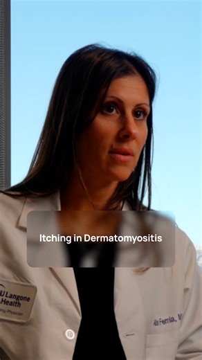 Itching isn't just a minor symptom in dermatomyositis. For many people, it's one of the hardest things to live with. Dr. Alisa Femia, Director of Dermatology-Rheumatology at NYU Langone Health, explains why scalp itch in particular can take over daily life, and why treating it often becomes a primary focus in dermatomyositis treatment plans. If itch has been affecting your quality of life, it's worth addressing with your care team. Hear more expert insights on managing dermatomyositis symptoms a
