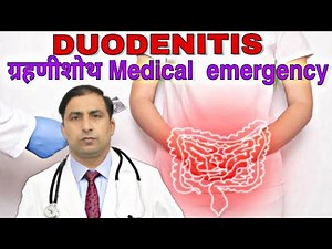 DUODENITIS ग्रहणीशोथ Medical emergency // Dr kumar education clinic