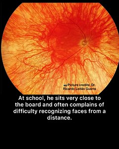 An interesting Case study | Optometry skills