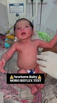 Newborn Baby Moro Reflex Test | What It Is & How It’s Checked 👶⚠️