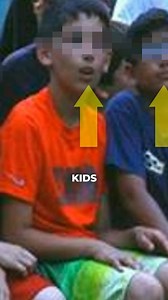 Battle between mouth and nose breathing. 😮‍💨🤧 #mewing #dentist #mew #fyp #breathing #airways #transformation #orthotropics #dentistry #mew | Orthotropics