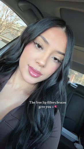 Gonna have to go get some after braces 😍 #fypシ゚viral #braces #fy