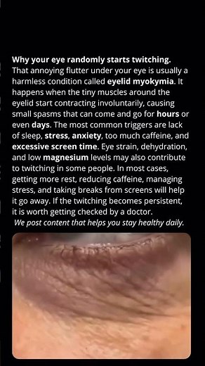 Why Your Eye Won’t Stop Twitching
