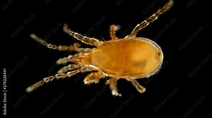 tick under the microscope, from the order Mesostigmata, possibly genus Hypoaspis, is a predator