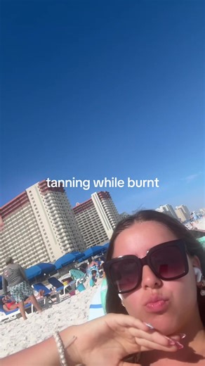 Sunburn to Tan: What Happens Next?