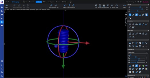 How to – Move implants in 3D in Planmeca Romexis