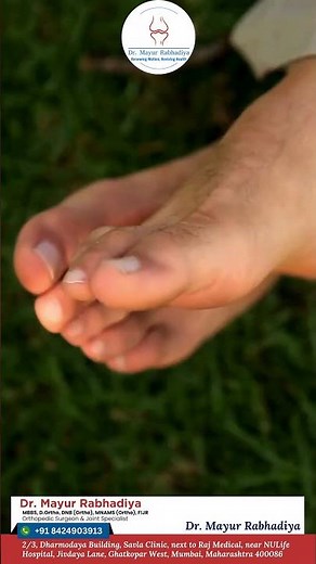 Hammer Toe Sufferers Are Making This ONE CRUCIAL Mistake Without Proper Treatment