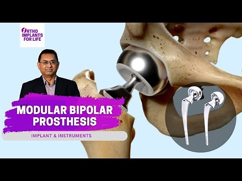 Modular Bipolar Prosthesis | Implants & Instruments