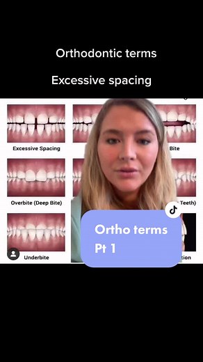 Understanding Orthodontic Terms Pt 1