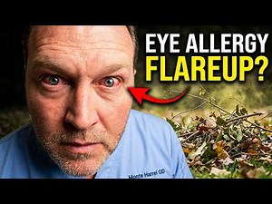 Acute Allergic Conjunctivitis Flareup: The Outdoor Allergen Nobody Warns You About