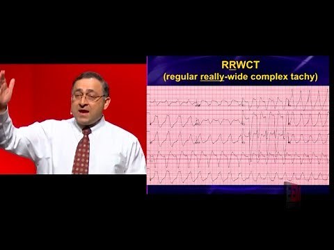 How do you avoid a clean kill with wide complex tachycardias?