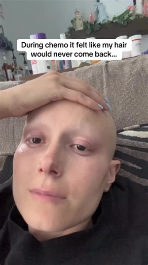 Chemo Hair Growth Journey: From Loss to Return